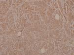 Phospho-MEK3 (Ser189) Antibody in Immunohistochemistry (Paraffin) (IHC (P))