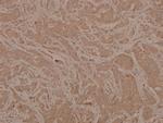 Phospho-MEK6 (Ser207) Antibody in Immunohistochemistry (Paraffin) (IHC (P))