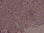 Phospho-c-Myc (Ser373) Antibody in Immunohistochemistry (Paraffin) (IHC (P))