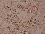 Phospho-c-Myc (Ser62) Antibody in Immunohistochemistry (Paraffin) (IHC (P))