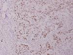 Phospho-c-Myc (Thr358) Antibody in Immunohistochemistry (Paraffin) (IHC (P))