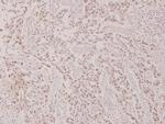 Phospho-c-Myc (Thr58) Antibody in Immunohistochemistry (Paraffin) (IHC (P))