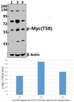 Phospho-c-Myc (Thr58) Antibody in Western Blot (WB)