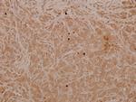 Phospho-MAP2K4 (Thr261) Antibody in Immunohistochemistry (Paraffin) (IHC (P))