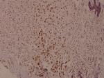 Phospho-Syk (Tyr525) Antibody in Immunohistochemistry (Paraffin) (IHC (P))