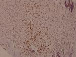 Phospho-Syk (Tyr525) Antibody in Immunohistochemistry (Paraffin) (IHC (P))