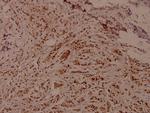 Phospho-WNK1 (Thr60) Antibody in Immunohistochemistry (Paraffin) (IHC (P))