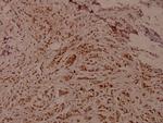 Phospho-WNK1 (Thr60) Antibody in Immunohistochemistry (Paraffin) (IHC (P))