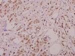 Phospho-BIK (Thr33) Antibody in Immunohistochemistry (Paraffin) (IHC (P))