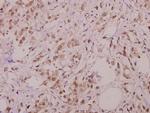 Phospho-BIK (Thr33) Antibody in Immunohistochemistry (Paraffin) (IHC (P))