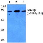 Phospho-IKK alpha/beta (Ser180, Ser181) Antibody in Western Blot (WB)