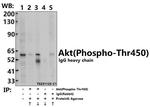 Phospho-AKT Pan (Thr450, Thr451, Thr447) Antibody in Immunoprecipitation (IP)