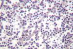 Phospho-Caspase 3 (Ser150) Antibody in Immunohistochemistry (Paraffin) (IHC (P))