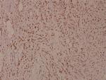 Phospho-MiTF (Ser180) Antibody in Immunohistochemistry (Paraffin) (IHC (P))