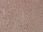 Phospho-MiTF (Ser180) Antibody in Immunohistochemistry (Paraffin) (IHC (P))