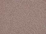 Phospho-INSR (Tyr1361) Antibody in Immunohistochemistry (Paraffin) (IHC (P))