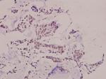 Phospho-SNAIL (Ser246) Antibody in Immunohistochemistry (Paraffin) (IHC (P))