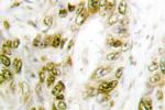 Phospho-IRF3 (Ser385) Antibody in Immunohistochemistry (Paraffin) (IHC (P))