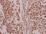 Phospho-PKC delta (Ser645) Antibody in Immunohistochemistry (Paraffin) (IHC (P))