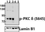 Phospho-PKC delta (Ser645) Antibody in Western Blot (WB)