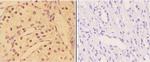 Phospho-AKT Pan (Tyr315, Tyr316, Tyr312) Antibody in Immunohistochemistry (Paraffin) (IHC (P))