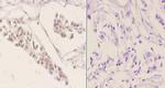 Phospho-ATF2 (Ser498) Antibody in Immunohistochemistry (Paraffin) (IHC (P))