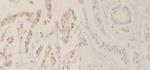 Phospho-NPM1 (Thr234) Antibody in Immunohistochemistry (Paraffin) (IHC (P))