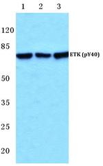 Phospho-ETK (Tyr40) Antibody in Western Blot (WB)