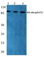 Phospho-IFNGR1 (Tyr457) Antibody in Western Blot (WB)