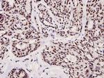 Phospho-FOXO3A (Ser253) Antibody in Immunohistochemistry (Paraffin) (IHC (P))