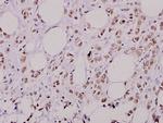 Phospho-AKT2 (Ser474) Antibody in Immunohistochemistry (Paraffin) (IHC (P))