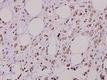 Phospho-AKT2 (Ser474) Antibody in Immunohistochemistry (Paraffin) (IHC (P))