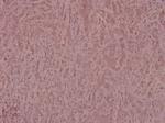 Phospho-IRS1 (Ser639) Antibody in Immunohistochemistry (Paraffin) (IHC (P))