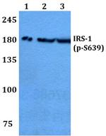 Phospho-IRS1 (Ser639) Antibody in Western Blot (WB)