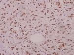 Phospho-JNK1/JNK2/JNK3 (Thr183) Antibody in Immunohistochemistry (Paraffin) (IHC (P))