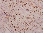 Phospho-CPI-17 (Thr38) Antibody in Immunohistochemistry (Paraffin) (IHC (P))