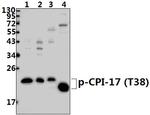 Phospho-CPI-17 (Thr38) Antibody in Western Blot (WB)