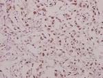 Phospho-GluR1 (Ser863) Antibody in Immunohistochemistry (Paraffin) (IHC (P))