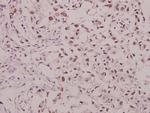 Phospho-GluR1 (Ser863) Antibody in Immunohistochemistry (Paraffin) (IHC (P))