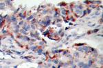 Phospho-JAK2 (Tyr221) Antibody in Immunohistochemistry (Paraffin) (IHC (P))