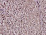 Phospho-HNF4A (Ser313) Antibody in Immunohistochemistry (Paraffin) (IHC (P))