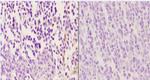 Phospho-Zap-70 (Tyr315) Antibody in Immunohistochemistry (Paraffin) (IHC (P))