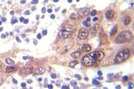 Phospho-LKB1 (Ser428) Antibody in Immunohistochemistry (Paraffin) (IHC (P))