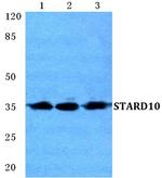 STARD10 Antibody in Western Blot (WB)