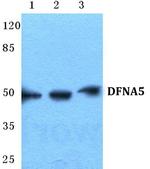 DFNA5 Antibody in Western Blot (WB)