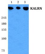 Kalirin Antibody in Western Blot (WB)