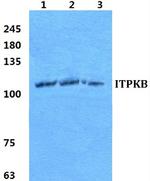 ITPKB Antibody in Western Blot (WB)