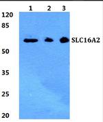 SLC16A2 Antibody in Western Blot (WB)