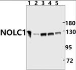 NOLC1 Antibody in Western Blot (WB)