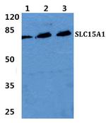 SLC15A1 Antibody in Western Blot (WB)